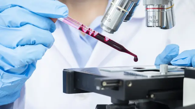 Exame de sangue que busca sinais de mais de 50 tipos de câncer chega ao Brasil